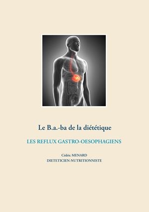 LE B.A.-BA DIÉTÉTIQUE DES REFLUX GASTRO-OESOPHAGIENS | 9782322204670 | MENARD, CEDRIC
