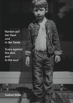 NARBEN AUF DER HAUT UND IN DER SEELE | 9783750493148 | HOLTZ, GUDRUN