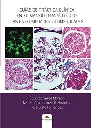 GUÍAS DE PRÁCTICA CLÍNICA EN EL MANEJO TERAPÉUTICO DE LAS ENFERMEDADES GLOMERULARES | 9788413170824 | VERDE MORENO, EDUARDO