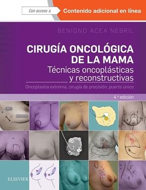 CIRUGIA ONCOLOGICA DE LA MAMA (4ª ED) | 9788491131120 | ACEA NEBRIL, BENIGNO