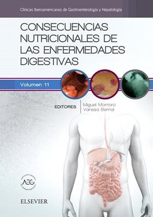 CONSECUENCIAS NUTRICIONALES DE LAS ENFERMEDADES DIGESTIVAS | 9788491131687 | MONTORO HUGUET, M.