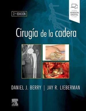 CIRUGIA DE LA CADERA (2ª ED) | 9788491139003 | BERRY