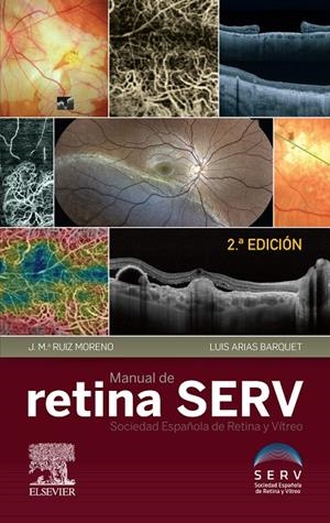 MANUAL DE RETINA SERV (2 ED) | 9788491135647 | SOCIEDAD ESPAÑOLA DE RETINA Y VITRIO