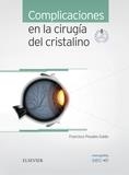 COMPLICACIONES EN LA CIRUGIA DEL CRISTALINO + ACCESO WEB | 9788491130345 | POYALES GALAN, FRANCISCO / GARZON JIMENEZ