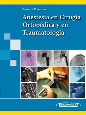 ANESTESIA EN CIRUGIA ORTOPEDICA Y EN TRAUMATOLOGIA | 9788498353211 | BASORA MACAYA, MISERICORDIA