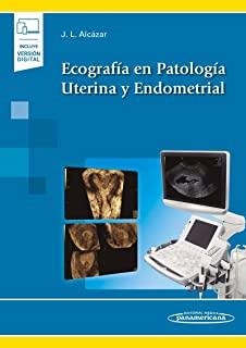 ECOGRAFIA EN PATOLOGIA UTERINA Y ENDOMETRIAL | 9788491106135 | ALCAZAR ZAMBRANO, JUAN LUIS