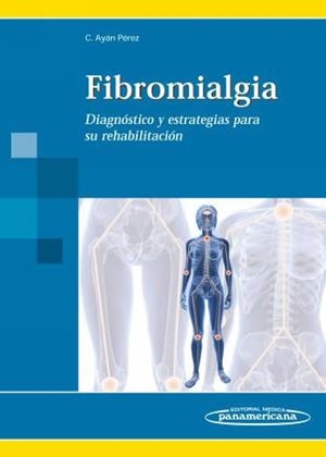 FIBROMIALGIA | 9788498353273 | AYAN PEREZ, CARLOS LUIS AYAN
