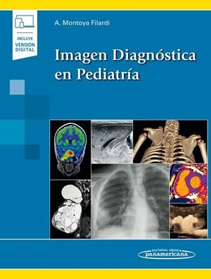 IMAGEN DIAGNOSTICA EN PEDIATRIA (INCLUYE VERSION DIGITAL) | 9788491106296 | MONTOYA FILARDI, ALEJANDRO / LLORENS SALVA