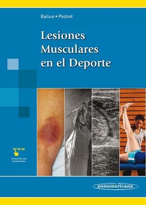 LESIONES MUSCULARES EN EL DEPORTE (INCLUYE EBOOK) | 9788491104797 | BALIUS MATAS, RAMON / PEDRET CARBALLIDO, C.