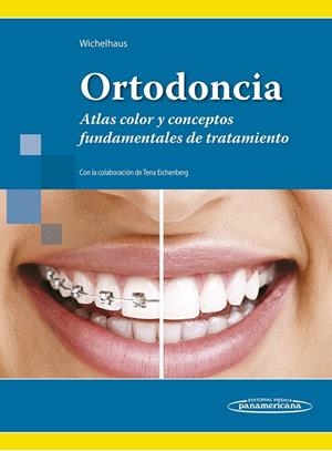 ORTODONCIA | 9786079356880 | WICHELHAUS