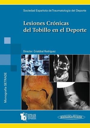 LESIONES CRONICAS DEL TOBILLO EN EL DEPORTE | 9788479037925 | RODRIGUEZ HERNANDEZ, CRISTOBAL
