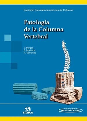 PATOLOGIA DE LA COLUMNA VERTEBRAL | 9788491100348 | SILACO SOCIEDAD IBEROLATINOAMERICANA DE COLUMNA/JESÚS BURGOS FLORES/ENRIQUE IZQUIERDO NÚÑEZ/HORACIO 