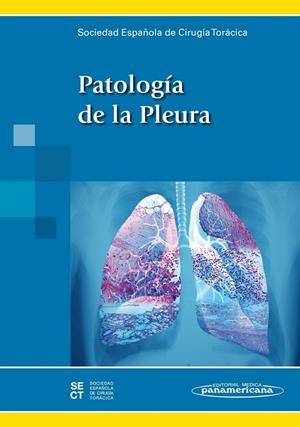 PATOLOGIA DE LA PLEURA | 9788498357929 | SECT SOCIEDAD ESPAÑOLA DE CIRUGÍA TORÁCICA/RICARDO GUIJARRO JORGE/MARÍA DEU MARTÍN/ANTONIO ÁLVAREZ K