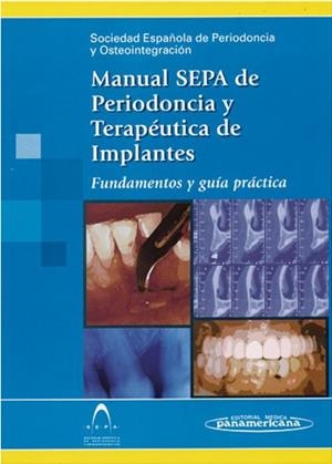 MANUAL SEPA DE PERIODONCIA Y TERAPEUTICA DE IMPLANTES | 9788479038793 | ECHEVERRIA GARCIA, JOSE JAVIER