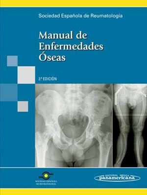 MANUAL DE ENFERMEDADES OSEAS | 9788498352306 | ARBOLEYA RODRIGUEZ, LUIS