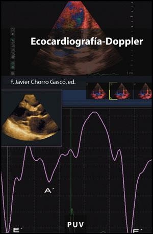 ECOCARDIOGRAFÍA-DOPPLER | 9788437078892 | VARIOS AUTORES
