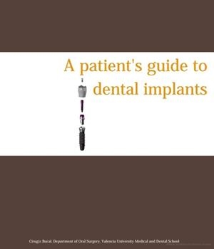 A PATIENT'S GUIDE TO DENTAL IMPLANTS | 9788437094427 | PEÑARROCHA DIAGO, MARÍA / PEÑARROCHA DIAGO, DAVID / VELARTE SAEZ, ROSARIO