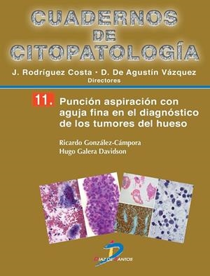 PUNCIÓN ASPIRACIÓN CON AGUJA FINA EN EL DIAGNÓSTICO DE LOS TUMORES DE HUESO | 9788499694221 | GONZÁLEZ CÁMPORA, RICARDO / GALERA DAVIDSON, HUGO