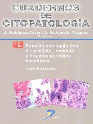 PUNCIÓN CON AGUJA FINA DE PRÓSTATA, TESTÍCULO Y ORGANOS GENITALES FEMENINOS | 9788499697826 | PÉREZ BARRIOS, ANDRÉS