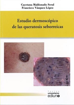ESTUDIO DERMOSCÓPICO DE LAS QUERATOSIS SEBORREICAS | 9788483179185 | MALDONADO SERAL, CAYETANA / VÁZQUEZ LÓPEZ, FRANCISCO