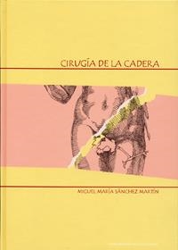 CIRUGÍA DE LA CADERA | 9788477629689 | SANCHEZ MARTIN, MIGUEL MARIA