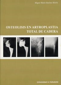 OSTEOLISIS EN ARTROPLASTIA TOTAL DE CADERA | 9788484484448 | SANCHEZ MARTIN, MIGUEL MARIA