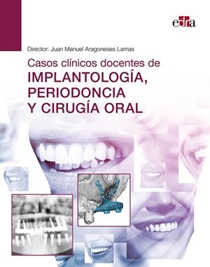 CASOS CLINICOS DOCENTES DE IMPLANTOLOGIA, PERIODONCIA Y CIRUGIA ORAL | 9788418706554 | ARAGONESES, JUAN MANUEL