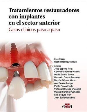 TRATAMIENTOS RESTAURADORES CON IMPLANTES EN EL SECTOR ANTERIOR | 9788418706431 | ESPONA ROIG,  JOSE / FERNANDEZ VILLARES, C.