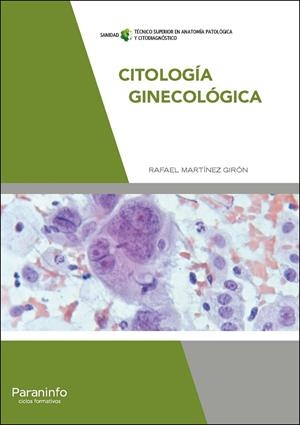 CITOLOGÍA GINECOLÓGICA | 9788428338059 | MARTINEZ GIRON, RAFAEL