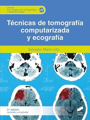 TECNICA DE TOMOGRAFIA COMPUTARIZADA Y ECOGRAFIA (3A EDICION REVISADA) | 9788413572154 | MARIN LILLO, SALVADOR