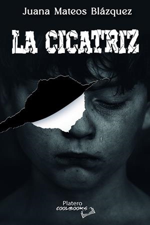 CICATRIZ, LA | 9788419492432 | MATEOS BLÁZQUEZ, JUANA
