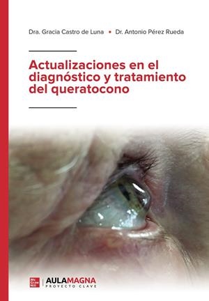 ACTUALIZACIONES EN EL DIAGNÓSTICO Y TRATAMIENTO DEL QUERATOCONO | 9788418392979 | CASTRO DE LUNA, DRA. GRACIA / PÉREZ RUEDA, DR. ANTONIO