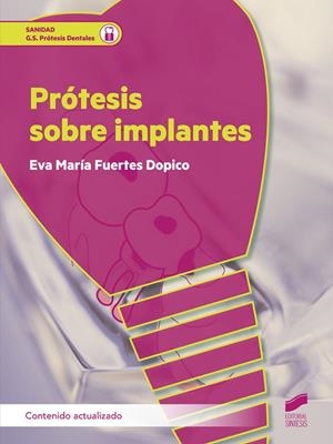 PRÓTESIS SOBRE IMPLANTES (CONTENIDO ACTUALIZADO) | 9788413573724 | FUERTES DOPICO, EVA MARIA