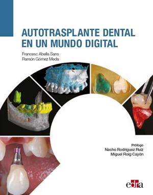 AUTOTRASPLANTE DENTAL EN UN MUNDO DIGITAL | 9788419156044 | GÓMEZ MEDA, RAMÓN / ABELLA SANS, FRANCESC