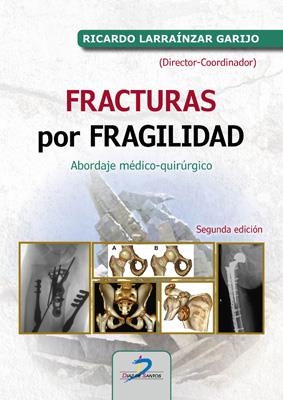 FRACTURAS POR FRAGILIDAD | 9788490522462 | LARRAÍNZAR GARIJO, RICARDO