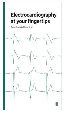 ELECTROCARDIOGRAPHY AT YOUR FINGERTIPS | 9788499846965 | BRUGADA TERRADELLAS, RAMON / SINGH, MANJOT