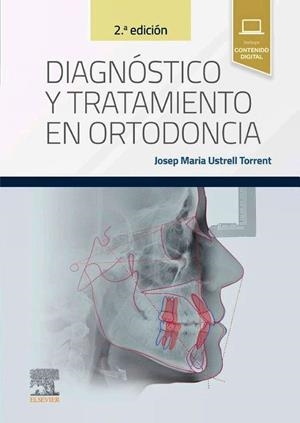 DIAGNOSTICO Y TRATAMIENTO EN ORTODONCIA (2ª EDICIÓN) | 9788413825632 | USTRELL