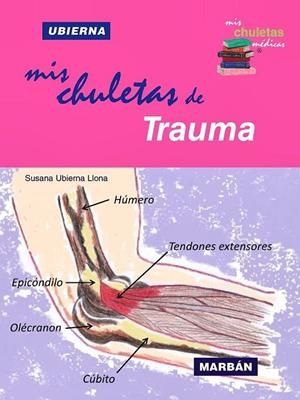 MIS CHULETAS DE TRAUMA | 9788419356727