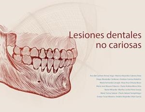 LESIONES DENTALES NO CARIOSAS | 9789978389478 | DEL CARMEN, ANA