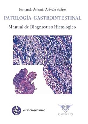 HISTODIAGNÓSTICO. PATOLOGÍA GASTROINTESTINAL | 9786125170064 | ARÉVALO SUÁREZ, FERNANDO ANTONIO