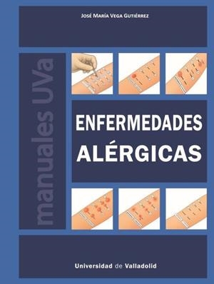 ENFERMEDADES ALERGICAS | 9788413203768 | VEGA GUTIERREZ, JOSE MARIA