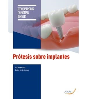 PROTESIS SOBRE IMPLANTES (2 ED.) | 9791388085727 | ACERO SANZ, JULIO/ARAGONESES LAMAS, M.A ISABEL/CORTÉS SÁNCHEZ, BETTINA/GUERRA MARTÍNEZ, ANA BELÉN/NÁ
