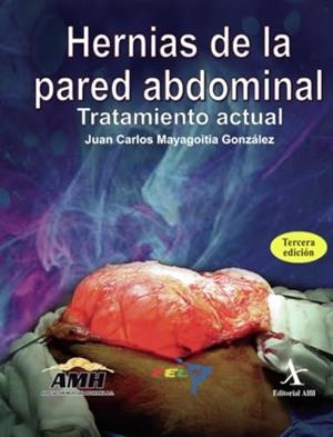 HERNIAS DE LA PARED ABDOMINAL. TRATAMIENTO ACTUAL | 9786077411260