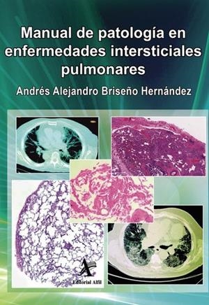 MANUAL DE PATOLOGÍA EN ENFERMEDADES INTERSTICIALES | 9786077412311